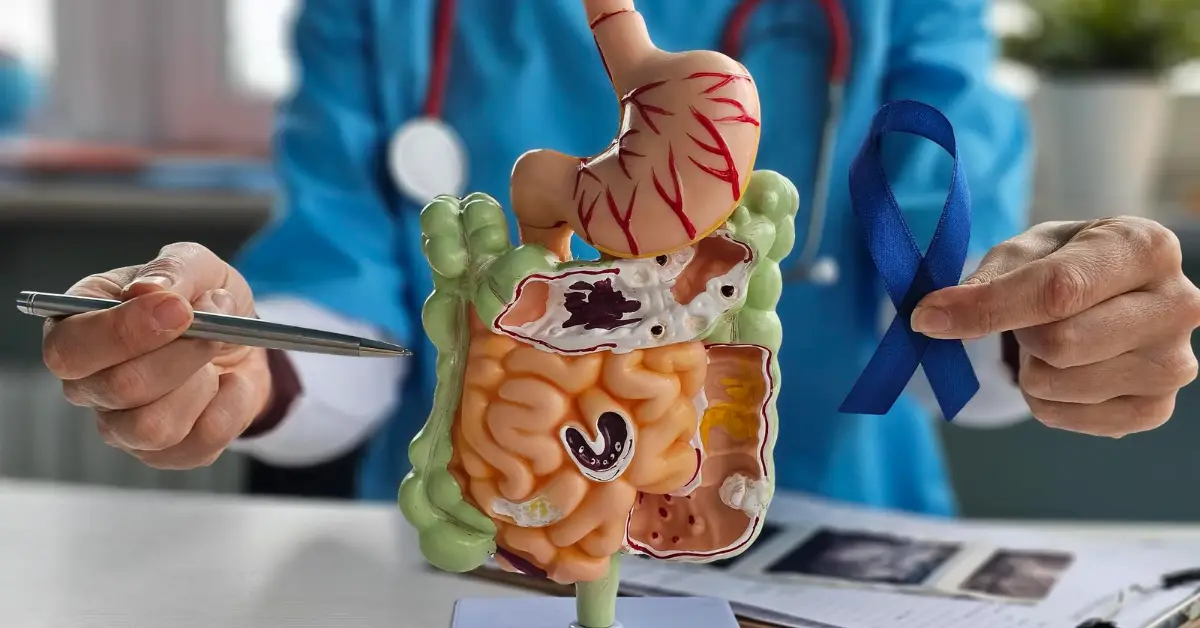 Gastrointestinal Oncology (Cancer Care)